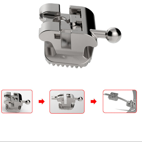 Dental Passive Self-Ligating Orthodontic Brackets 24pcs - Roth 0.022 Hooks 3 4 5 with 1st Molar Buccal Tubes
