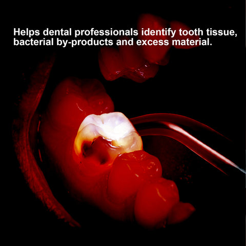 Dental Dual-UV Smart Flashlight | Caries Detection 395nm UV + 6000K White LED
